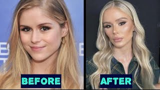 Actress Erin Moriarty Plastic Surgery Before And After [upl. by Dnomar]