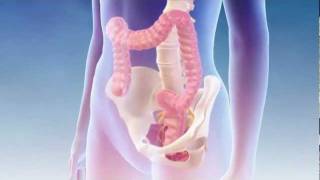 Fecal Incontinence  Interstim Bowel Mechanism of Action [upl. by Stolzer157]