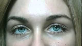 Bright Ocular surgery to change your eye color permanently to ice gray [upl. by Annavoj]