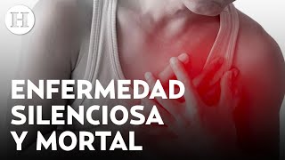 ¡Embolias e infartos Hipertensión arterial una enfermedad silenciosa causas y factores de riesgo [upl. by Bluefield244]