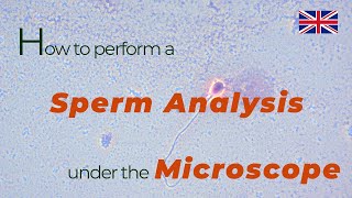 How to perform a sperm analysis under the microscope  urologist göttingen [upl. by Maidel703]