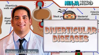 Diverticular Diseases  Clinical Medicine [upl. by Hardan]