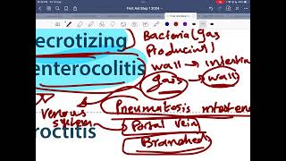 GI pathology 3 [upl. by Haland]