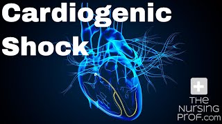 How to Manage Cardiogenic Shock [upl. by Nivlac]