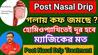 গলায় কফ জমে   হোমিওপ্যাথিতেই দূর হবে ম্যাজিকের মত  homeopathy medicine for Post Nasal Drip [upl. by Hacim145]