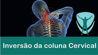 A inversão da coluna cervical e sua relação com a dor CPXITC VERTEBRAL [upl. by Norad]