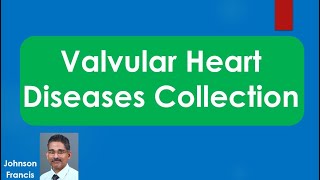 Valvular Heart Disease Collection [upl. by Yrrab361]