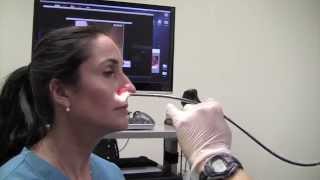 Esophagoscopy Without Sedation TransNasal Esophagoscopy Esophagus Exam Endoscopy [upl. by Verdie748]