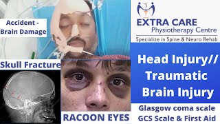 Head Injury Symptoms in hindi Brain injury Types First Aid  GCS Scale  Traumatic Brain Injury TBI [upl. by Fairbanks]