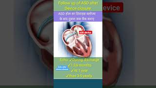 when do Echo after asd device closure l echo asd shorts [upl. by Thgirw]