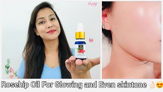 Rosehip Oil For Glowing And Even Skin tone 😍  Full Review  Demo  Good Vibes Rosehip Oil [upl. by Oicnaneb]