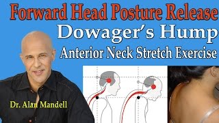 Forward Head Posture Release Dowagers Hump Anterior Neck Stretches  Dr Mandell [upl. by Isdnyl]