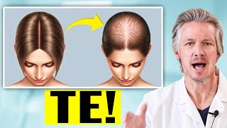 TELOGEN EFFLUVIUM STRESS SHEDDING AND HOW TO GO ABOUT FIXING IT [upl. by Eve]