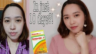 Poten Cee Collagen Review  Effective Collagen Supplement [upl. by Yhtomot]