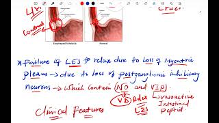 GI Pathology Esophagus part 2 [upl. by Jeffcott]