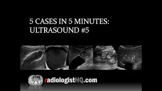 5 Cases in 5 Minutes Ultrasound 5 [upl. by Frodi]