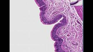 Histopathology Lung bronchus Cryptosporidium [upl. by Cayser]