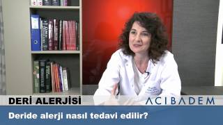 Deride alerji nasıl tedavi edilir [upl. by Ogir]