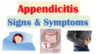 Appendicitis Signs amp Symptoms  amp Why They Occur [upl. by Ettennad]