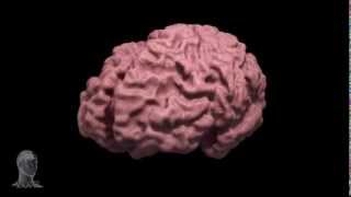 Alzheimers disease brain morph [upl. by Rebor]