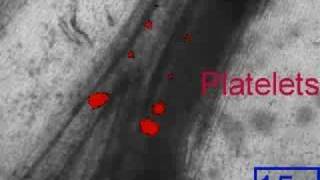 Platelet accumulation following a FeCl3 injury on mesentery [upl. by Airolg]