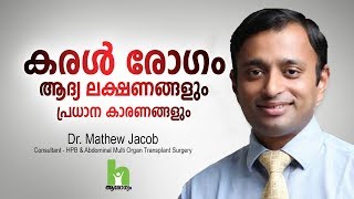 കരൾ രോഗത്തിന്റെ ഈ ലക്ഷണങ്ങൾ സൂക്ഷിക്കുക  Liver Disease Malayalam Health Tips [upl. by Madelene]