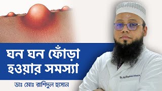 শরীরে ফোঁড়া হলে করনীয় ফোঁড়া কি এবং কেন হয় ফোঁড়ার চিকিৎসা ও প্রতিরোধে করনীয় কি কি [upl. by Anitnahs]