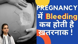 Bleeding In Pregnancy  Pregnancy me Bleeding Kyo Hoti Hai  Dr Mayuri Kothiwala Jaipur [upl. by Larrie]