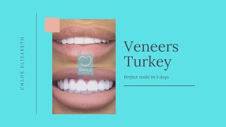 VENEERS TURKEY CHLOE ELIZABETH REVIEW 2019 [upl. by Anneis]