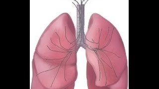 BREATH SOUNDS Stages of Fluid Overload Pneumonia [upl. by Janene863]