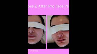 DERMALOGICA FACE PEEL [upl. by Oswin]