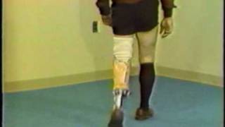 Gait deviations relating to a transtibial prosthesis [upl. by Warms]