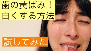 【歯の黄ばみをすぐ白くする】簡単に、すぐ落ちた！家でやってみた！ [upl. by Yttocs]