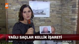 Saçı yağlı olanlar dikkat  atv Ana Haber [upl. by Etnaed]