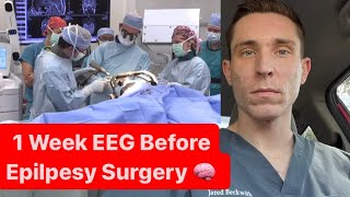 1 Week EEG Before Epilepsy Surgery [upl. by Llednol]