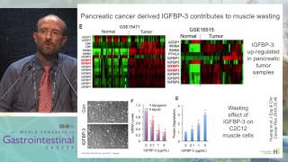 Cancer cachexia and sarcopenia in GI cancer Mechanism and ways to interfere with it [upl. by Jannery]