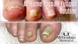 👣DIY Pedicure At Home  Simple Tips amp Tricks for Daily Toenail Care👣 [upl. by Eellehs]