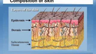 Hydrocolloid Technology amp SureSKIN II Dressings [upl. by Hafeenah]