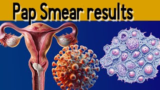 Pap Smear Results Explained under 3 minutes [upl. by Unity]