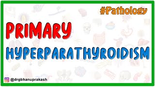 Primary Hyperparathyroidism  Etiology  Pathogenesis  Pathology  Diagnosis and Treatment [upl. by Haneen]