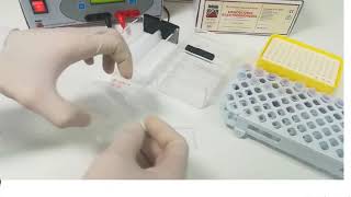 Hemoglobin electrophoresis procedure [upl. by Arres599]