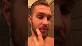 Patchy Beard does growing for 5 months help Part 25 [upl. by Kaylyn]