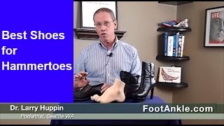 Best Shoes for Hammertoes  Seattle Podiatrist Larry Huppin [upl. by Nicolais]