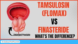 Tamsulosin Flomax Vs Finasteride for Benign Prostatic Hyperplasia  Side Effects You MUST Know [upl. by Anagrom]