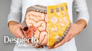 Síntomas del cáncer de colon y cómo prevenirlo [upl. by Ahsital989]