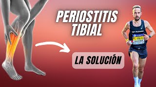 ❌ Descubre Cómo ELIMINAR la PERIOSTITIS TIBIAL FUNCIONA ✅ [upl. by Aerdna]