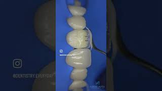 Dentin layerdentistry [upl. by Sadirah]