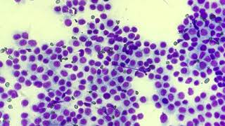 Histiocytoma cytology [upl. by Hulen]