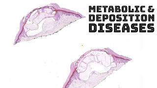 Metabolism amp Deposition Diseases in Skin dermatology dermpath pathology board review [upl. by Peggy421]