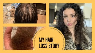 MY HAIR LOSS STORY how to recover from telogen effluvium [upl. by Haimes]